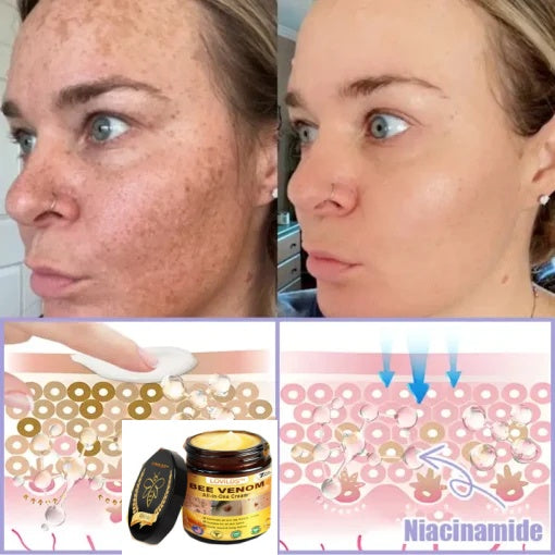 LOVILDS® Bee Venom Lift Cream