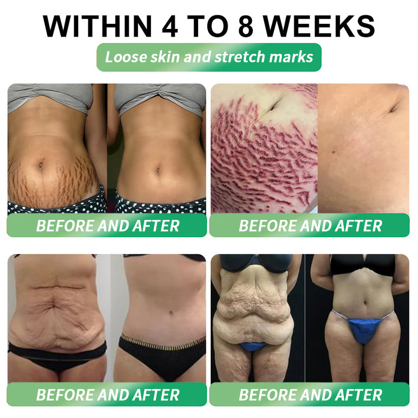 💡Divifit 𝑶𝒇𝒇𝒊𝒄𝒊𝒂𝒍 𝑺𝒕𝒐𝒓𝒆 | 💯Divifit®🇺🇸𝐺𝐿𝑃-𝟏  𝑺𝒊𝒙-𝒊𝒏-𝑶𝒏𝒆 𝑯𝒆𝒂𝒍𝒕𝒉 𝑺𝒐𝒍𝒖𝒕𝒊𝒐𝒏 𝑶𝒓𝒂𝒍 𝑳𝒊𝒒𝒖𝒊𝒅  (𝐉𝐮𝐬𝐭 𝐨𝐧𝐜𝐞 𝐚 𝐝𝐚𝐲, 𝐯𝐢𝐬𝐢𝐛𝐥𝐞 𝐜𝐡𝐚𝐧𝐠𝐞𝐬 𝐢𝐧 𝟕 𝐝𝐚𝐲𝐬） ✅ 𝐅𝐨𝐫 𝐨𝐛𝐞𝐬𝐢𝐭𝐲, 𝐜𝐚𝐫𝐝𝐢𝐨𝐯𝐚𝐬𝐜𝐮𝐥𝐚𝐫 𝐡𝐞𝐚𝐥𝐭𝐡, 𝐝𝐢𝐚𝐛𝐞𝐭𝐞𝐬, 𝐬𝐥𝐞𝐞𝐩 𝐚𝐩𝐧𝐞𝐚, 𝐆𝐮𝐭 𝐇𝐞𝐚𝐥𝐭𝐡, 𝐣𝐨𝐢𝐧𝐭 𝐢𝐬𝐬𝐮𝐞𝐬, 𝐚𝐧𝐝 𝐦𝐨𝐫𝐞