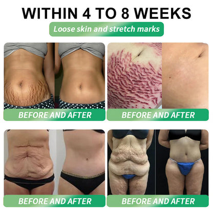 💡Divifit 𝑶𝒇𝒇𝒊𝒄𝒊𝒂𝒍 𝑺𝒕𝒐𝒓𝒆 | 💯Divifit®🇺🇸𝐺𝐿𝑃-𝟏  𝑺𝒊𝒙-𝒊𝒏-𝑶𝒏𝒆 𝑯𝒆𝒂𝒍𝒕𝒉 𝑺𝒐𝒍𝒖𝒕𝒊𝒐𝒏 𝑶𝒓𝒂𝒍 𝑳𝒊𝒒𝒖𝒊𝒅  (𝐉𝐮𝐬𝐭 𝐨𝐧𝐜𝐞 𝐚 𝐝𝐚𝐲, 𝐯𝐢𝐬𝐢𝐛𝐥𝐞 𝐜𝐡𝐚𝐧𝐠𝐞𝐬 𝐢𝐧 𝟕 𝐝𝐚𝐲𝐬） ✅ 𝐅𝐨𝐫 𝐨𝐛𝐞𝐬𝐢𝐭𝐲, 𝐜𝐚𝐫𝐝𝐢𝐨𝐯𝐚𝐬𝐜𝐮𝐥𝐚𝐫 𝐡𝐞𝐚𝐥𝐭𝐡, 𝐝𝐢𝐚𝐛𝐞𝐭𝐞𝐬, 𝐬𝐥𝐞𝐞𝐩 𝐚𝐩𝐧𝐞𝐚, 𝐆𝐮𝐭 𝐇𝐞𝐚𝐥𝐭𝐡, 𝐣𝐨𝐢𝐧𝐭 𝐢𝐬𝐬𝐮𝐞𝐬, 𝐚𝐧𝐝 𝐦𝐨𝐫𝐞