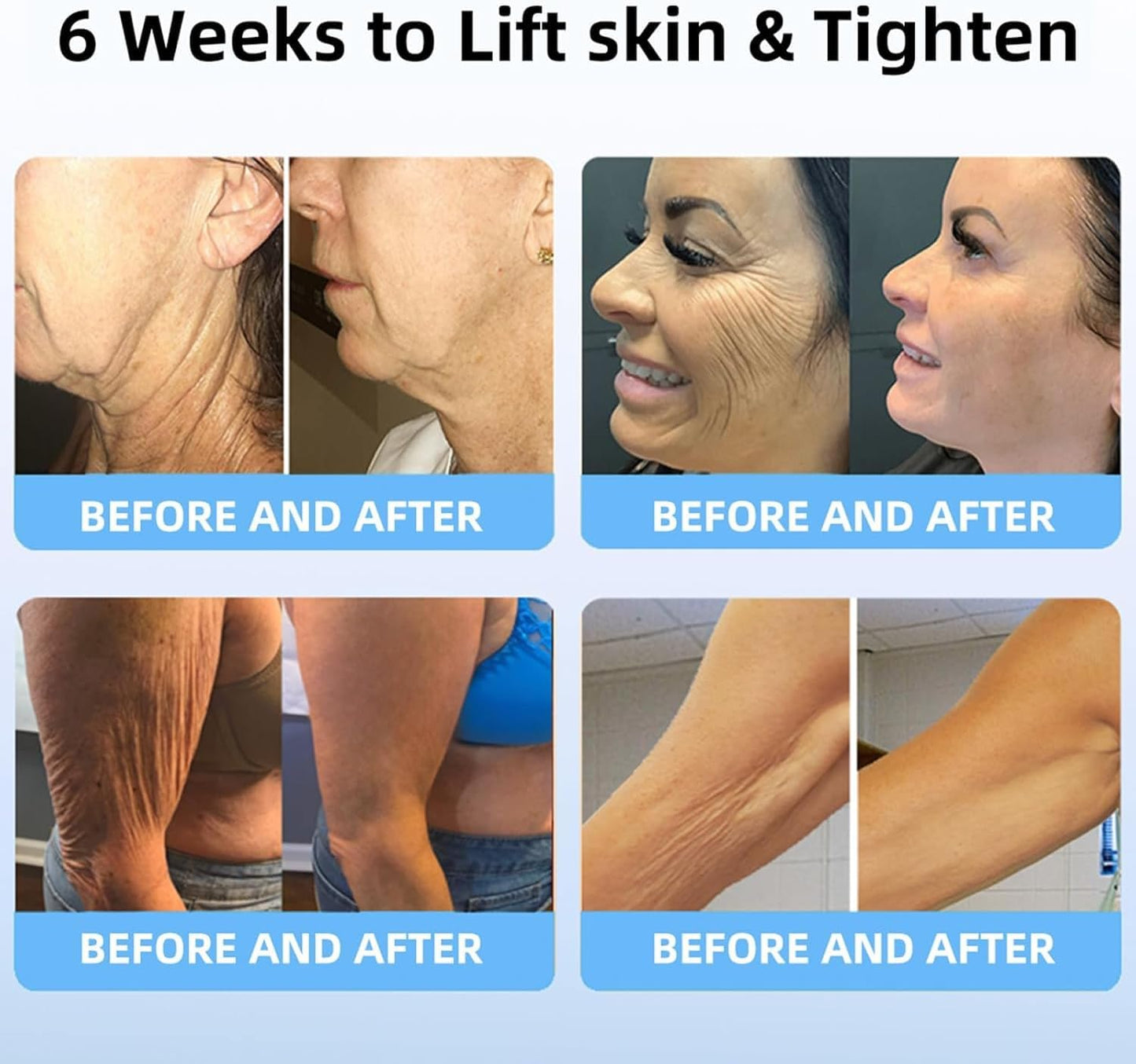 LOVILDS® Bee Venom Lift Cream