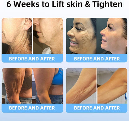 LOVILDS® Bee Venom Lift Cream