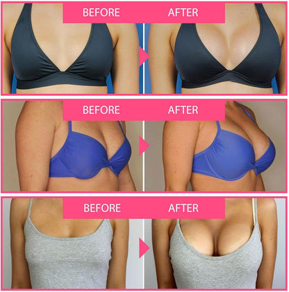 LOVILDS® Bee Venom Lift Cream