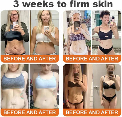 LOVILDS® Bee Venom Lift Cream