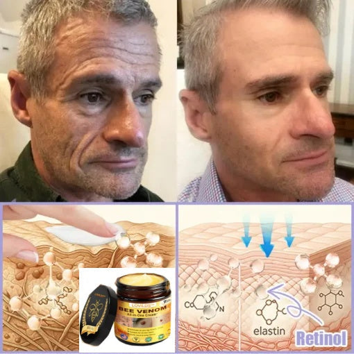 LOVILDS® Bee Venom Lift Cream