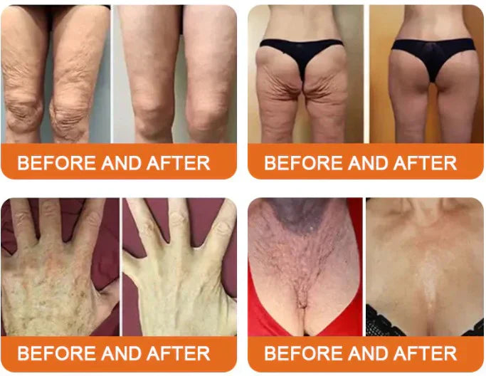 LOVILDS® Bee Venom Lift Cream